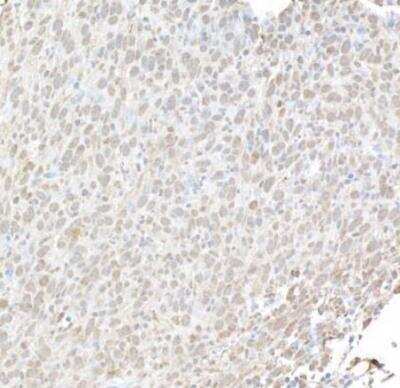 Immunohistochemical Analysis of Histone H2AX in Paraffin Embedded Mouse CT26 Colon Carcinoma